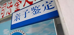 雅安司法DNA鉴定流程是怎样的，司法亲子鉴定采集哪些样本